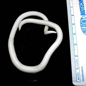 图:CDC Division of Parasitic Diseases http:… · Public domain · Wikimedia Commons 线虫动物门